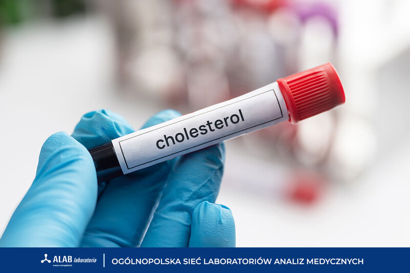 Lipidogram - jedno z podstawowych badań w profilaktyce zdrowia. Czym jest i kiedy wykonać?
