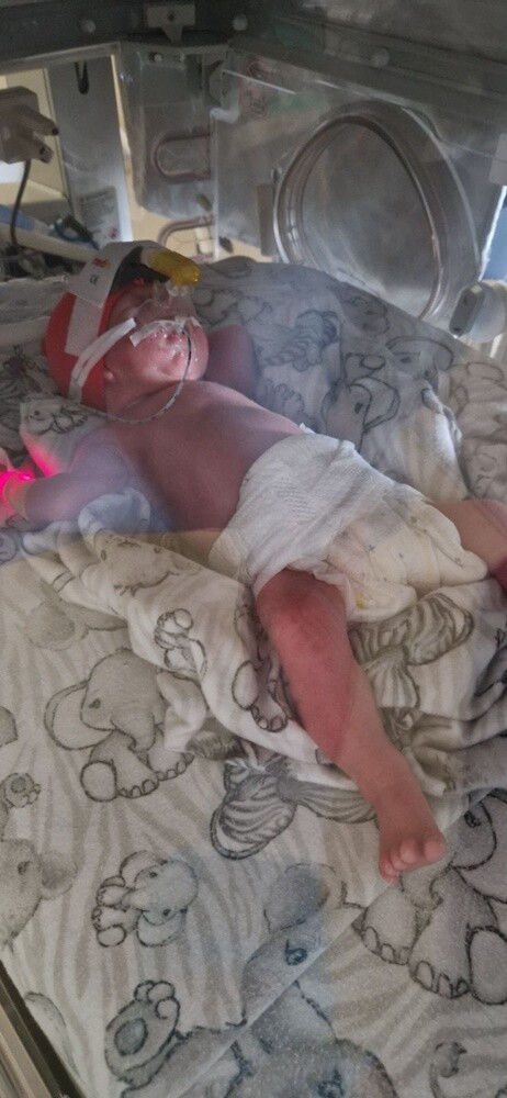 W rudzkim szpitalu urodziły się kolejne trojaczki! / fot. Szpital Miejski w Rudzie Śląskiej